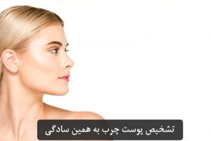 هرآنچه که راجب پوست چرب باید بدانید