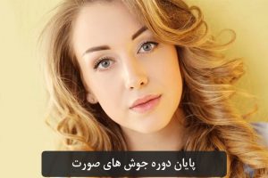 شناخت انواع جوش و درمان همیشگی آن