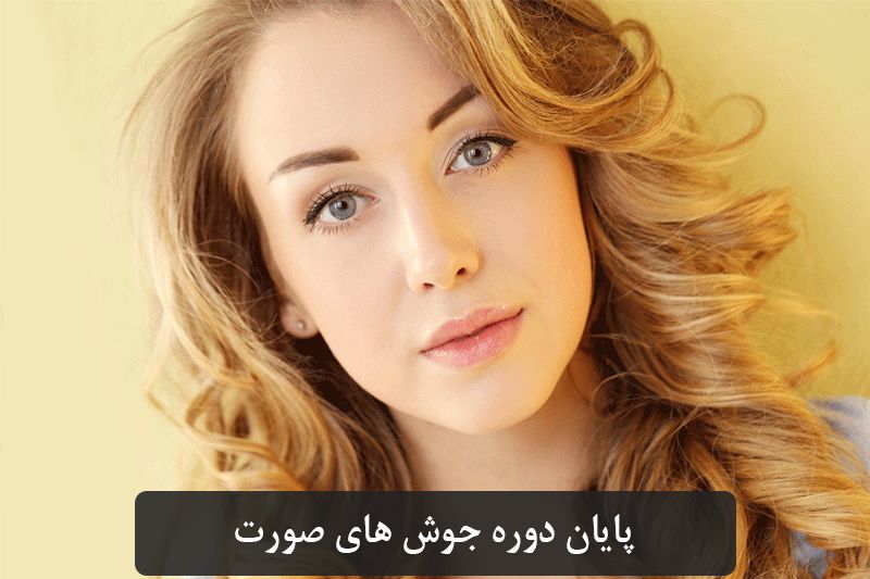 شناخت اواع جوش و درمان سریع آن